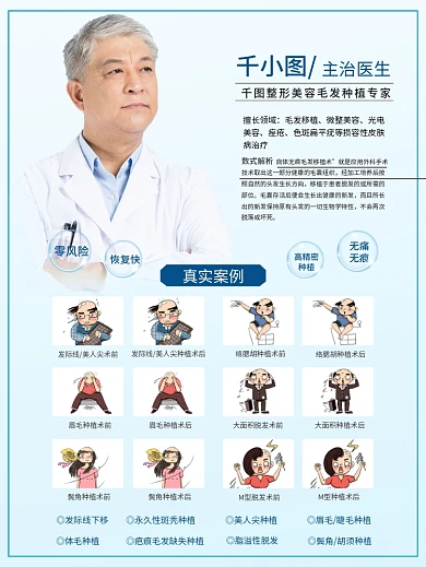 植发脱毛秃头毛发移植海报广告宣传品原创