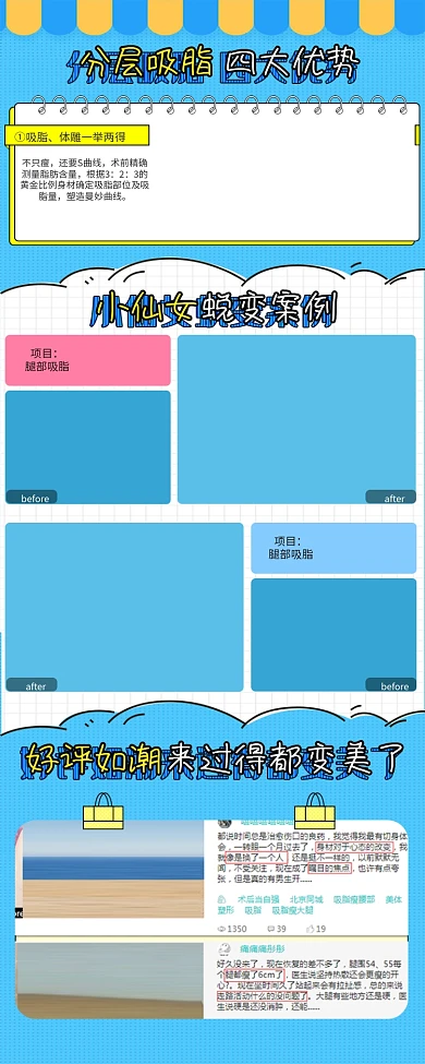 分层吸脂蜕变案例