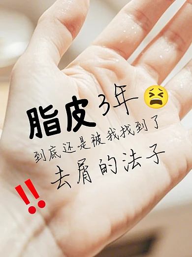 去屑攻略洗发水推荐小红书封面