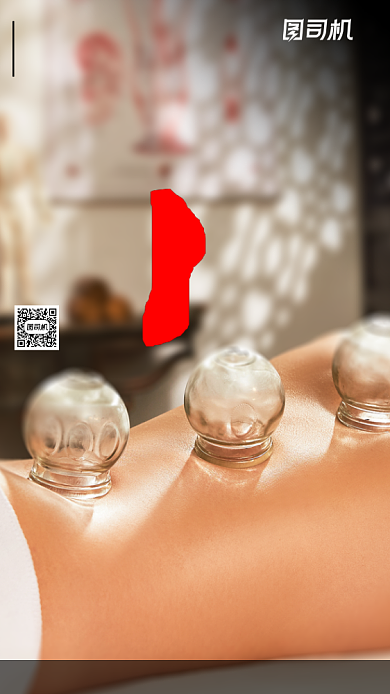 中医拔罐摄影手机海报背景