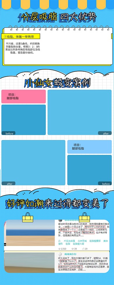分层吸脂蜕变案例