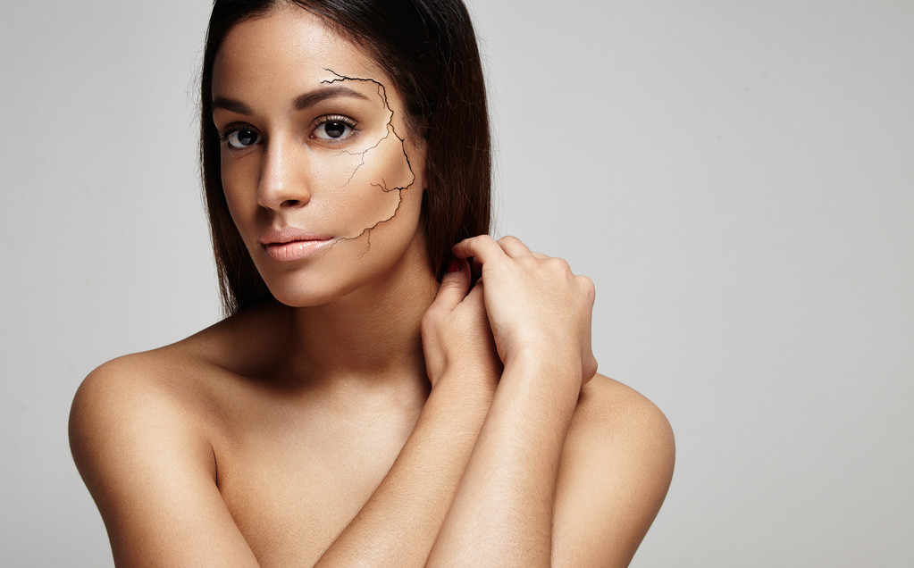 女性面部皮肤破 女性面部皮肤破