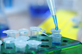 试管、 滴管图片