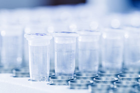 聚合酶链反应在等待 dna 样本