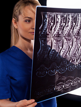 颈椎 mri 检查的医生图片