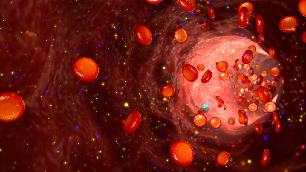 血流量的影响容器图片 血流量的影响容器图片