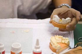 牙医工作与义齿照片