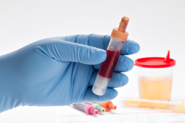 尿液和血液檢查 （全血細(xì)胞計數(shù))