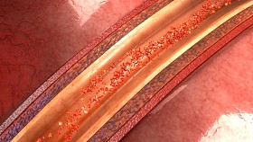 人体动脉解剖图片