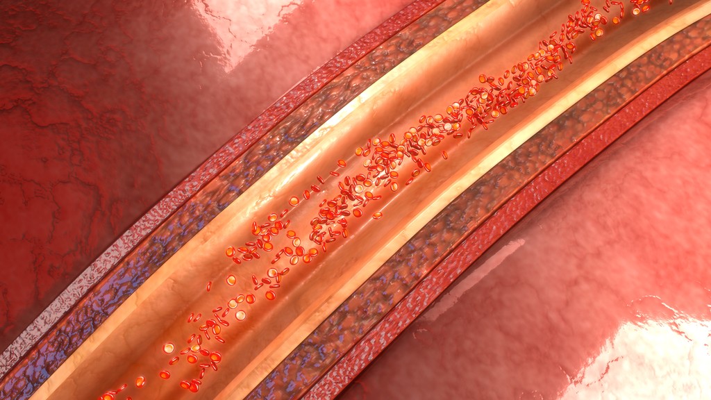 人体动脉解剖图片