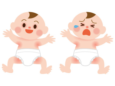 嬰兒哭在皮疹