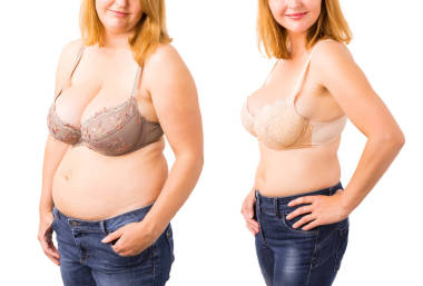 女人之前和之后重量損失