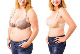 女人之前和之后重量损失