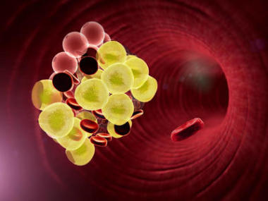 脂肪细胞和血液中的红细胞图片