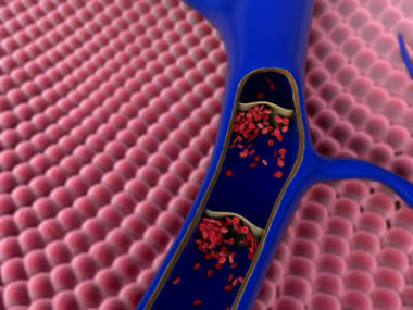 動脈與切出部分所示照片