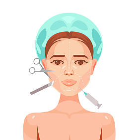 整形手术。女人的脸。矢量平面卡通插画