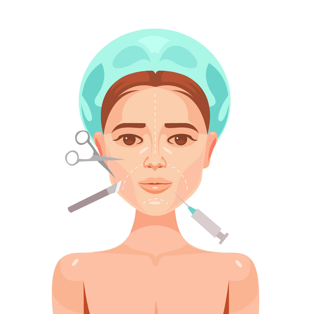 整形手术。女人的脸。矢量平面卡通插画