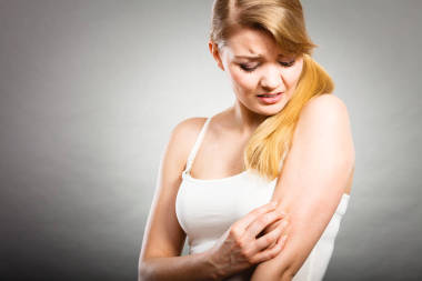 女人抓癢胳膊與過敏皮疹