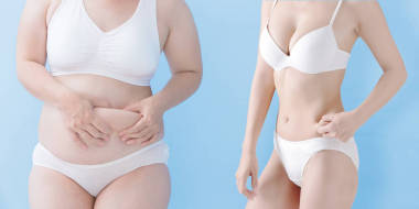 胖女人和苗條的女人