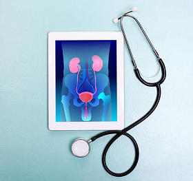 泌尿外科概念平板电脑