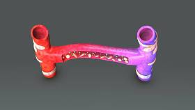 毛细血管扩散图