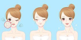 痤疮问题的女人