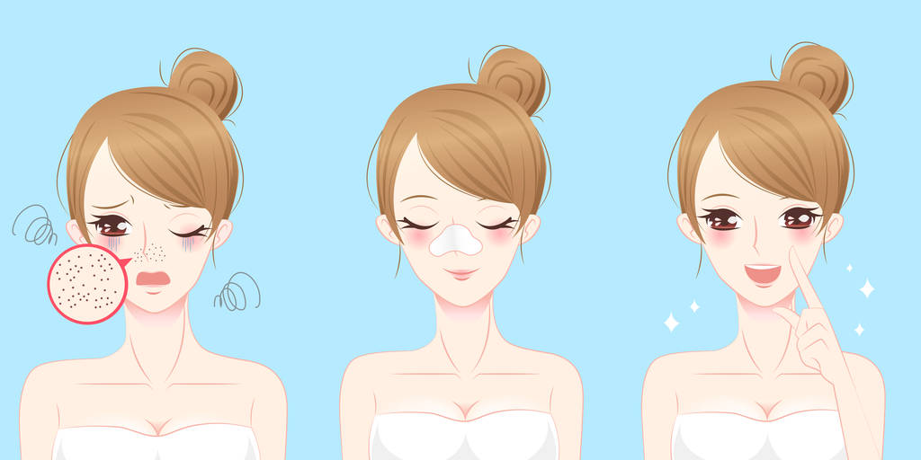 痤疮问题的女人