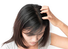 特写女人手发痒的头皮，头发护理概念