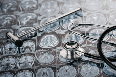 反射锤和听诊器图片