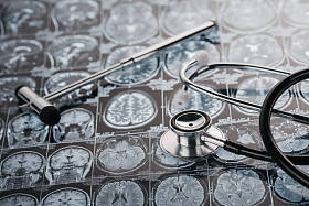 反射锤和听诊器图片