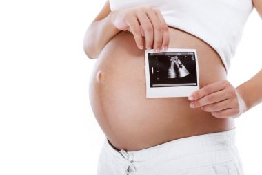 怀孕的女人举行前腹部超声图片 怀孕的女人举行前腹部超声图片