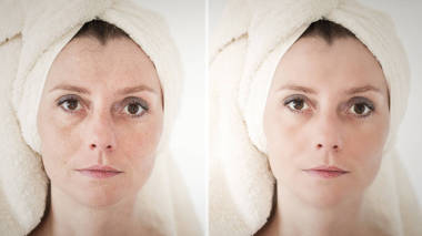 美概念-护肤、 抗衰老程序、 复兴