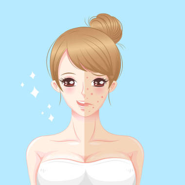 女人護(hù)膚問題