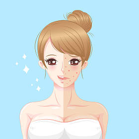 女人护肤问题