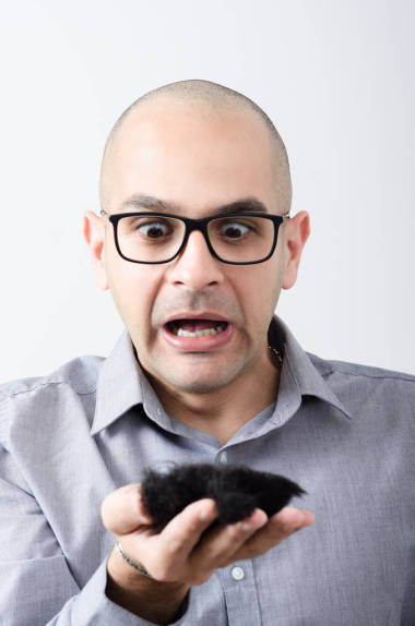 秃头男人控股头发图片