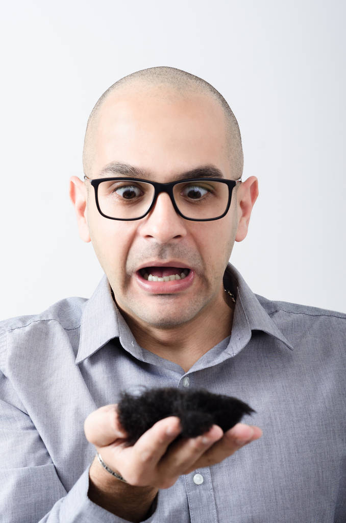 秃头男人控股头发图片 秃头男人控股头发图片