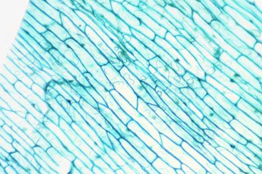 微观的世界。洋葱表皮细胞.图片 微观的世界。洋葱表皮细胞.图片