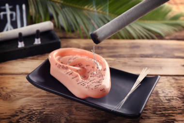 艾條灸和針灸針