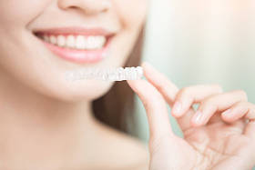 微笑与隐形牙套的女人图片