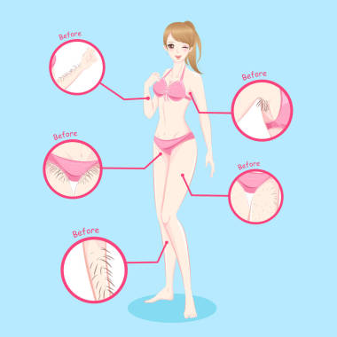 頭發(fā)去除概念