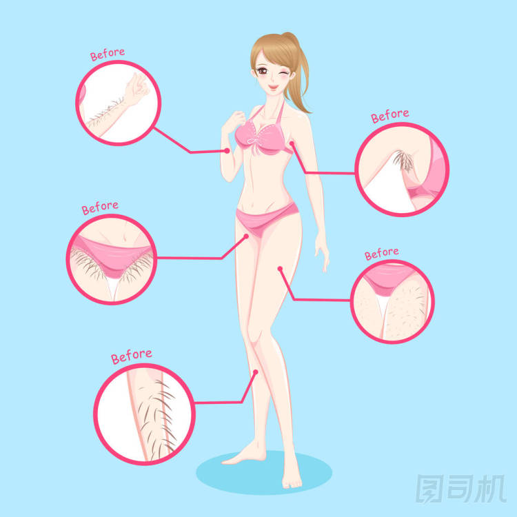 頭發(fā)去除概念