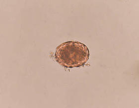 凳子考试蛔虫蛔虫卵.图片