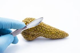 医生准备削减与胰腺的手术刀图白色背景上。医疗手术干预和手术治疗的胰腺和肝胆解剖区的概念照片