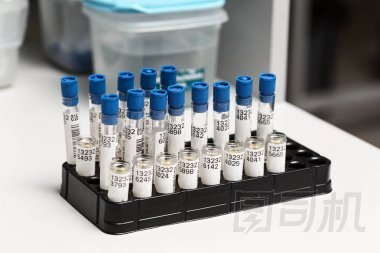 在醫(yī)用推車上安排的測試管圖片