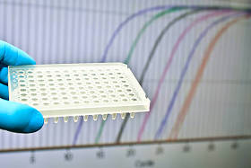 Dna 检测实时 Pcr 法