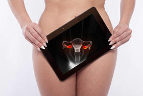 妇女 reproductiv 器官的筛选