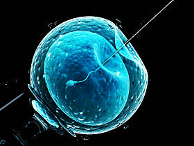 人工受精。针穿刺细胞膜图片