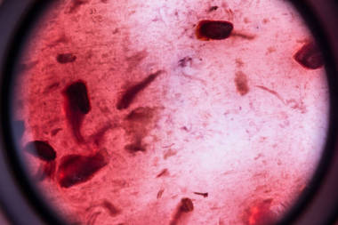 細(xì)菌和微生物的模仿, 微觀觀點(diǎn), 宏觀背景