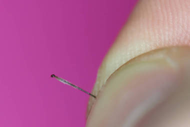 頭發(fā)根部閉合