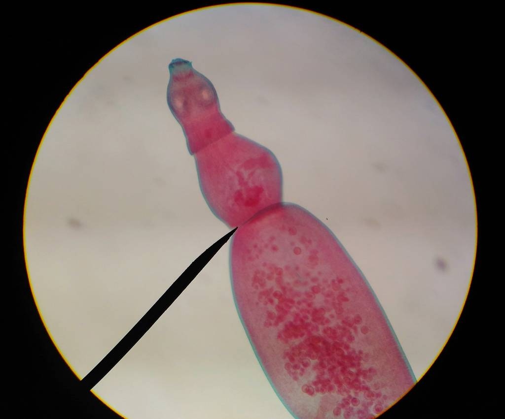 与成人的寄生虫关闭鸡蛋.图片 与成人的寄生虫关闭鸡蛋.图片